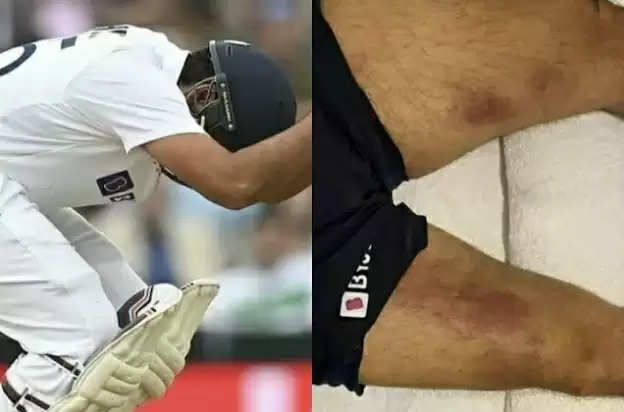 Rohit knee injury